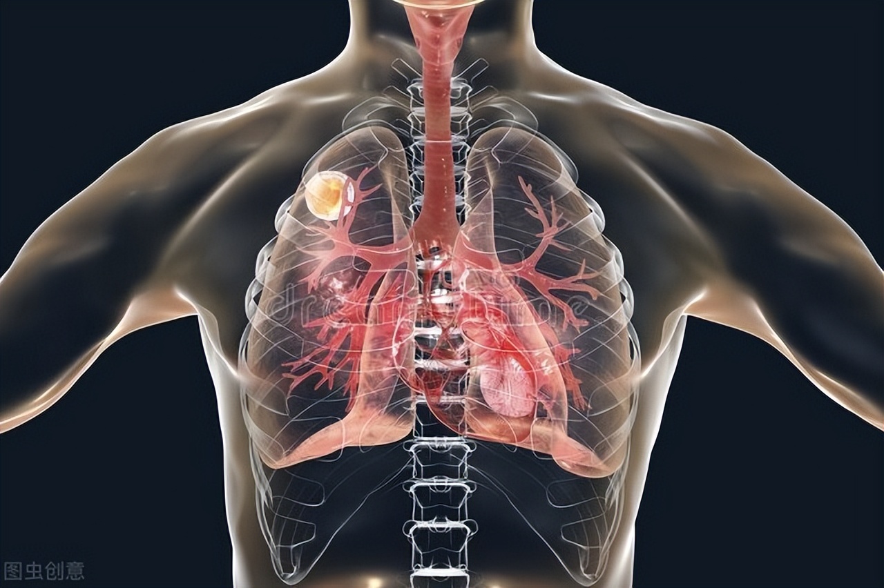 嗓子干痒咳嗽是什么病前兆,嗓子经常有痰是肺部有炎症