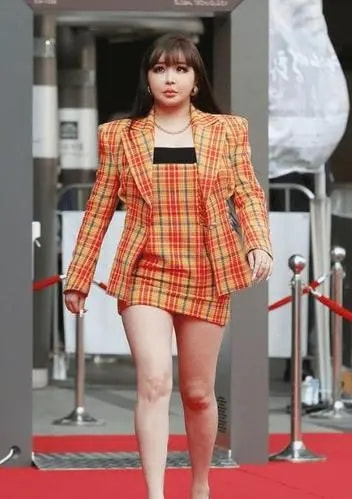 她曾比Lisa还火爆，却因服用“禁药”被*制抵**，如今宛如“充气人”