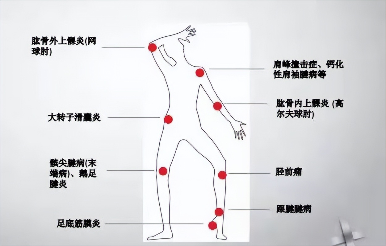 慢性疼痛理疗项目,慢性疼痛的新疗法
