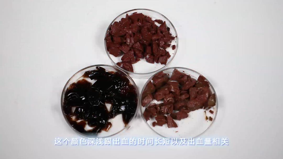 经血颜色辨别,经血到底什么颜色才算正常