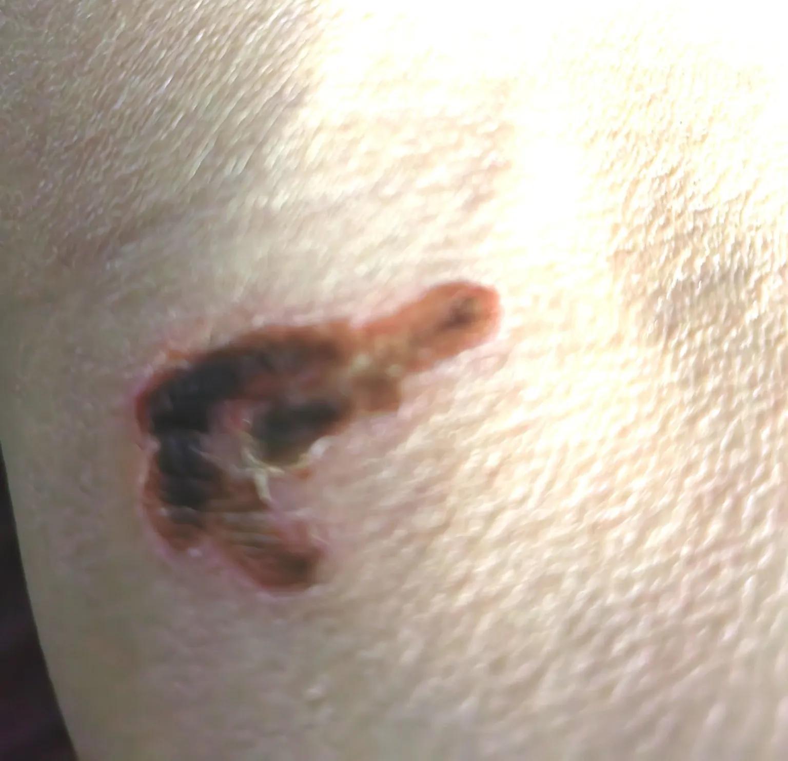 养狗人是怎么处理被狗咬到的,养狗被自家狗咬伤了怎么办