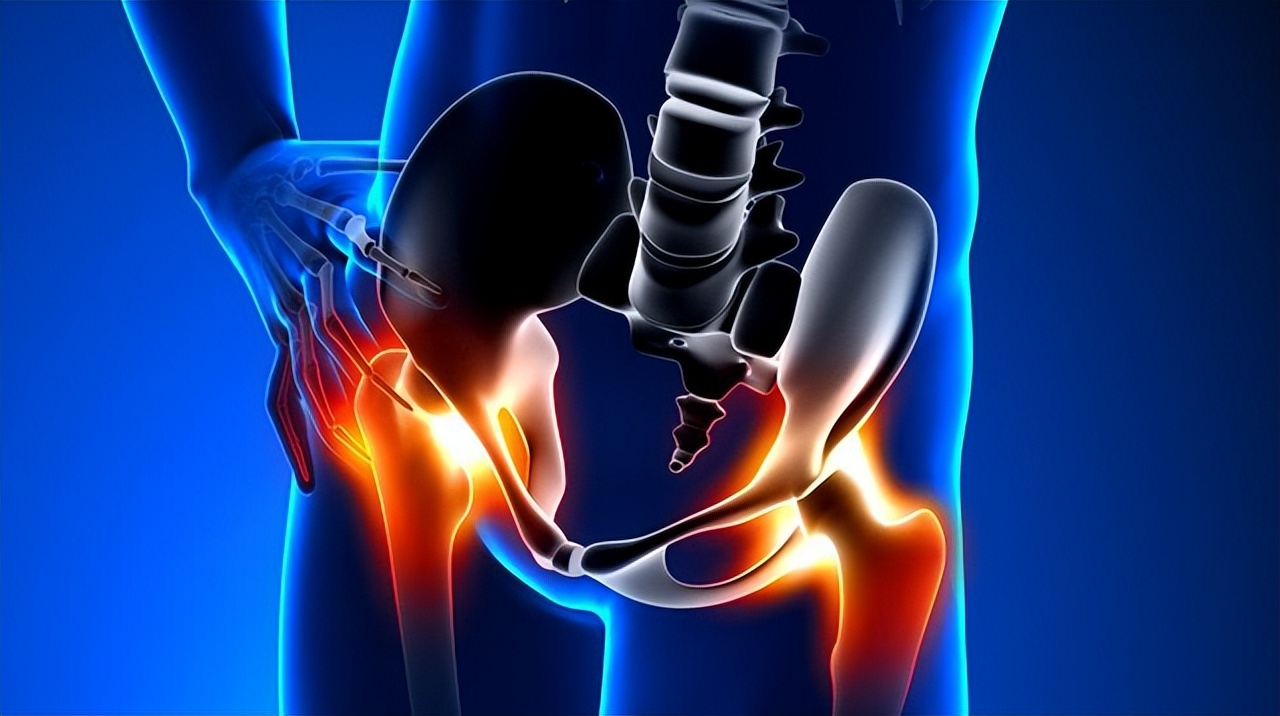 股骨头取钉后坏死有什么症状,男性患股骨头坏死的全身症状