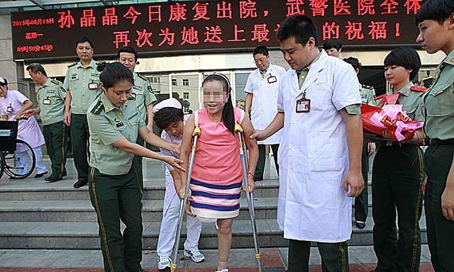 小腿巨粗的女孩,河南女子患病腿粗如大象