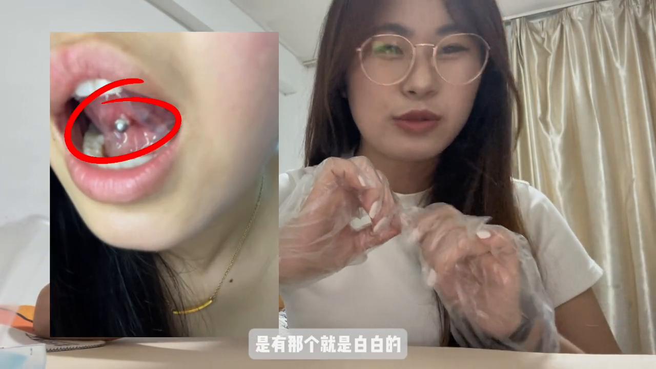 想打舌钉好久了一直在纠结,舌钉打了几天想摘了