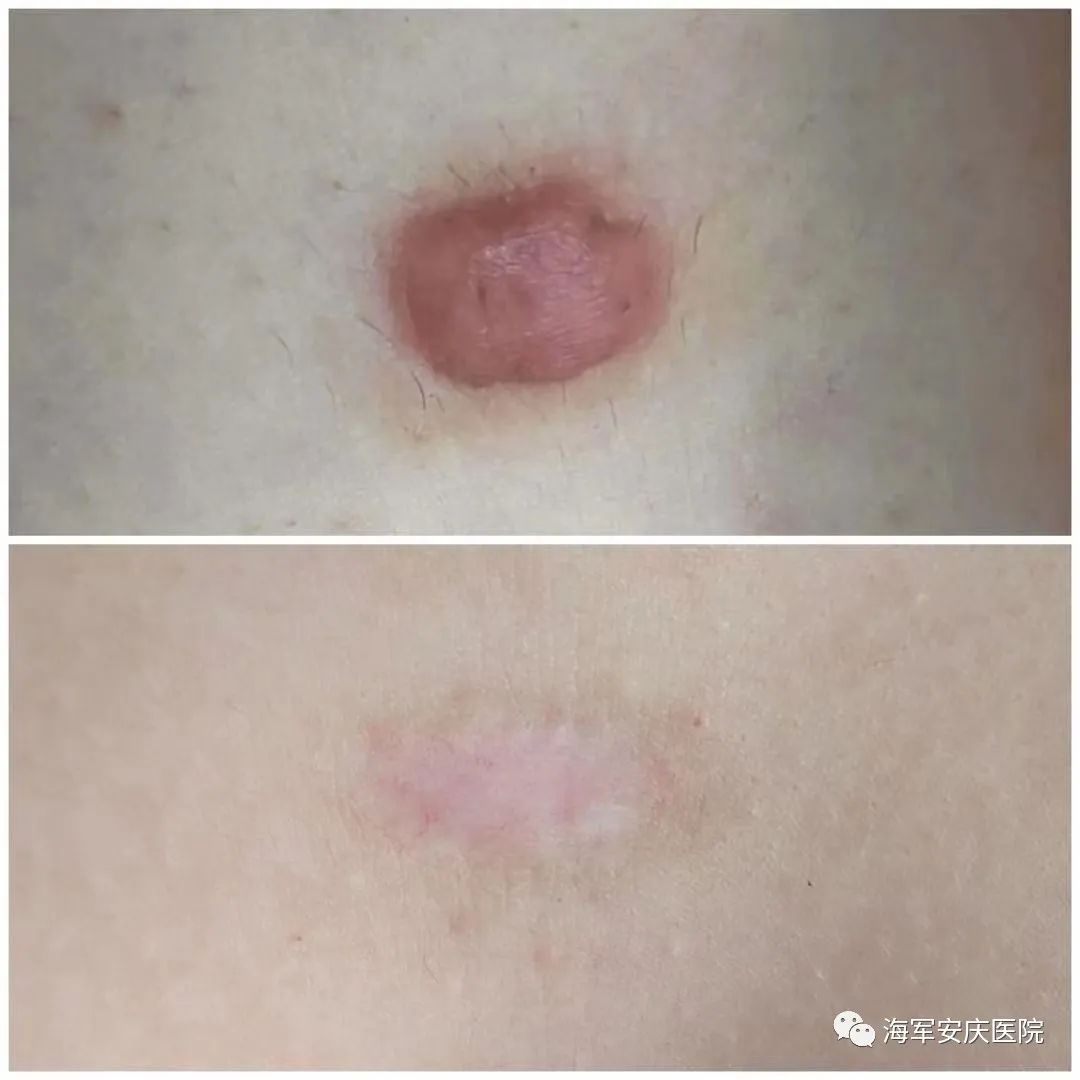 安庆市第一人民医院核医学科,安庆116医院核医学科