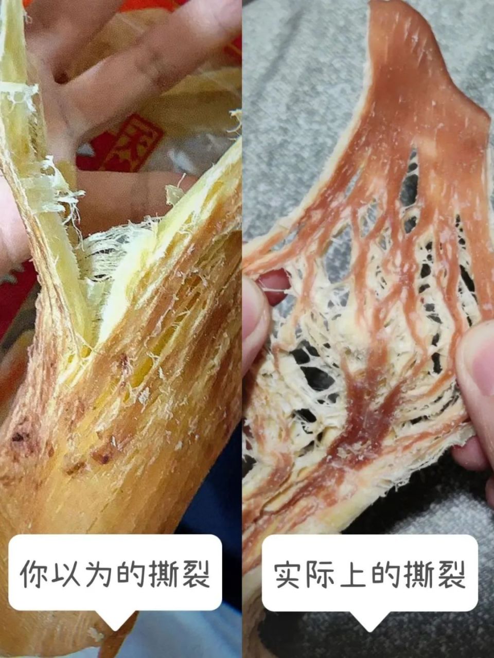 刚生完孩子子宫像芒果,生孩子撕裂伤口像芒果