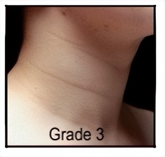 不要让颈纹出卖了你的年纪,不要让颈纹出卖你的年纪