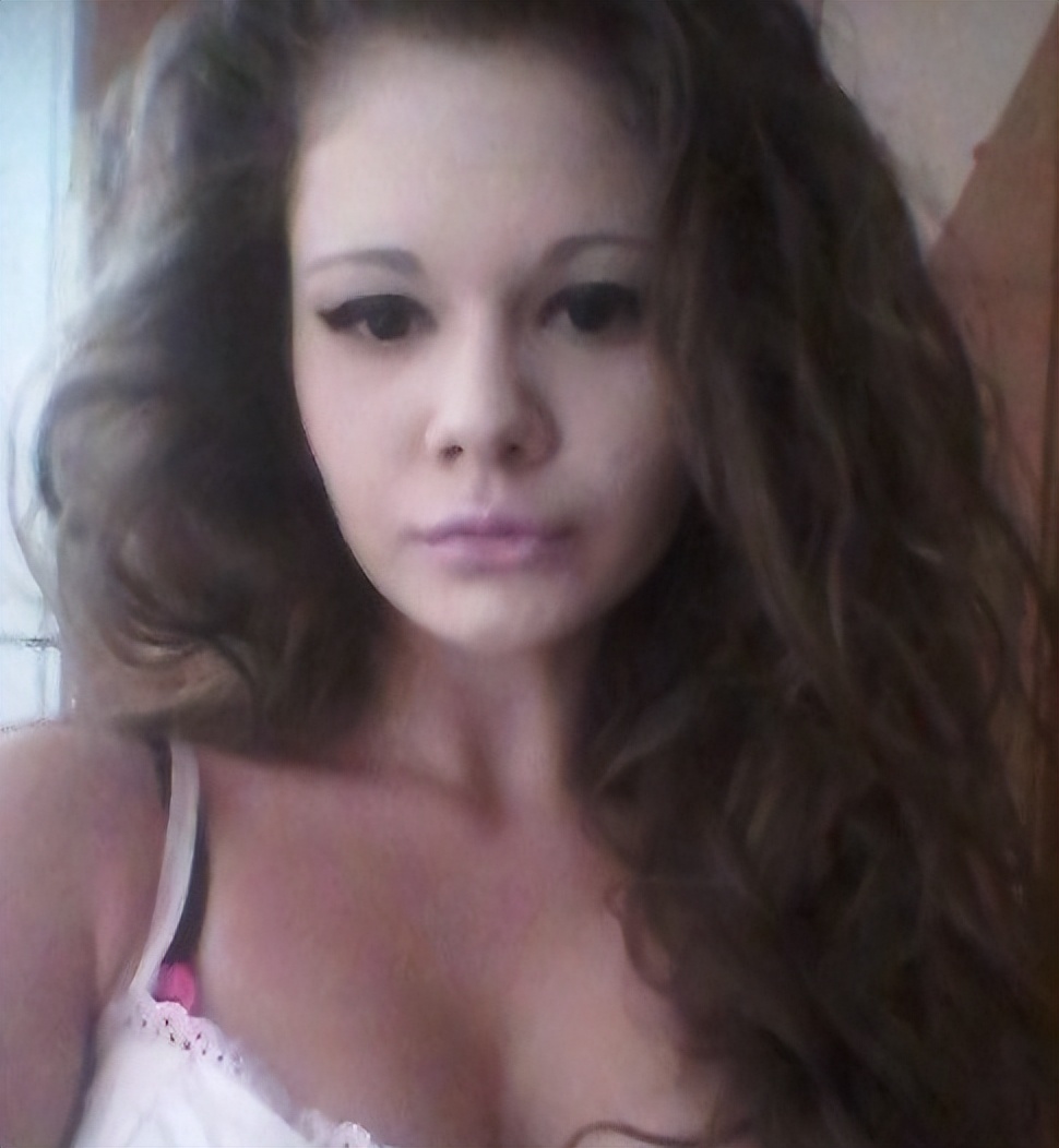 女子狂打30支玻尿酸,丰唇针建议打吗