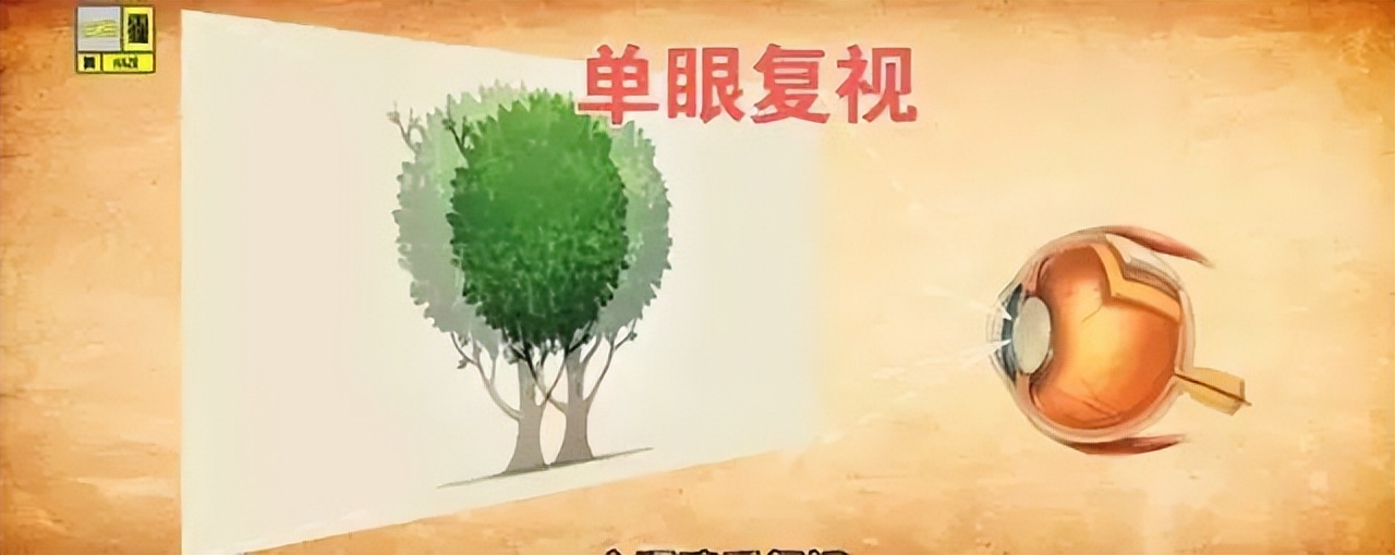 警惕四种致盲眼疾,致盲眼病的早期症状