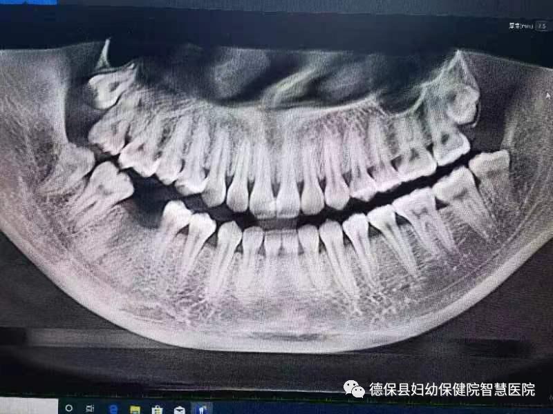 德保县妇幼保健院建设项目,德保人民医院牙科可种牙吗