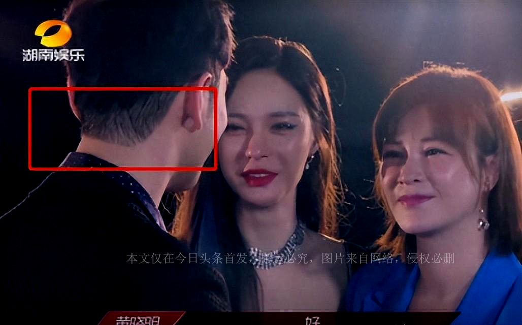 秃头潘玮柏,明星是怎么解决脱发的