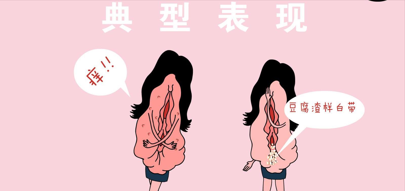 怀孕后下体有股臭味正常吗,怀孕以后下边有异味是怎么回事