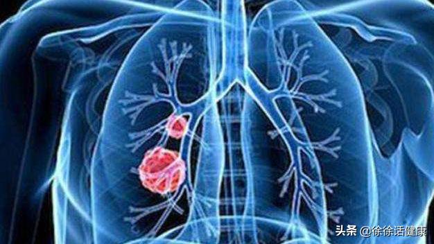 肿瘤标志物正常代表没有癌吗,肿瘤标志物都代表啥