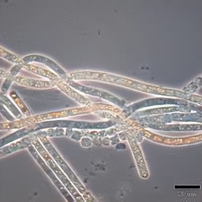 肠道菌包括哪些菌种,肠道菌群微生物种类分析