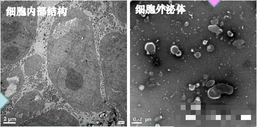 tem测试主要测什么,tem测试材料表面出现暗条纹