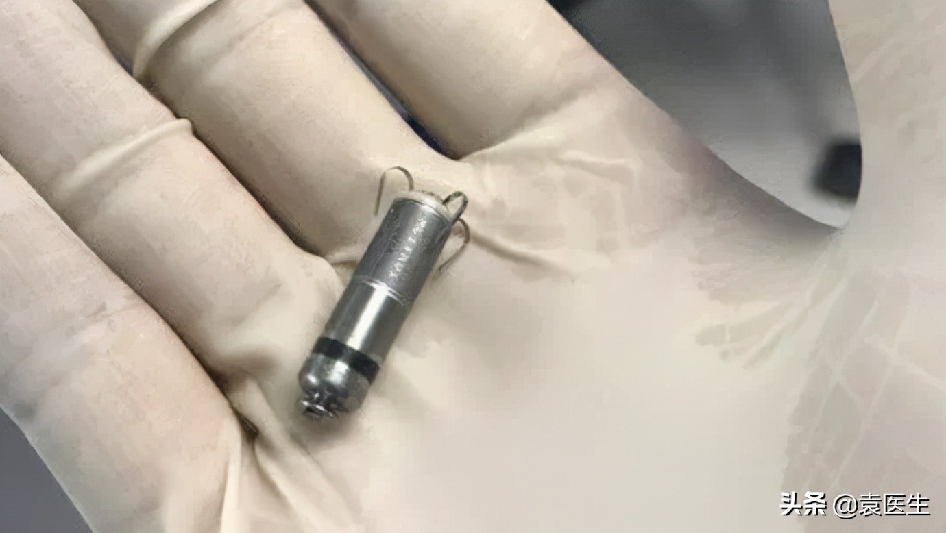 心脏起搏器安装以后心跳还会慢吗,心脏跳得有点快需做什么微创手术