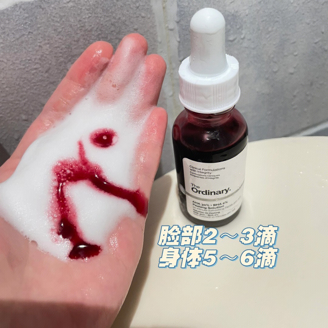 如何淡化腿上肥胖纹小窍门,腿上有肥胖纹怎么遮瑕