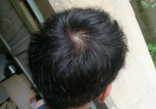 孩子头上的旋有什么含义,孩子头上的旋代表着什么