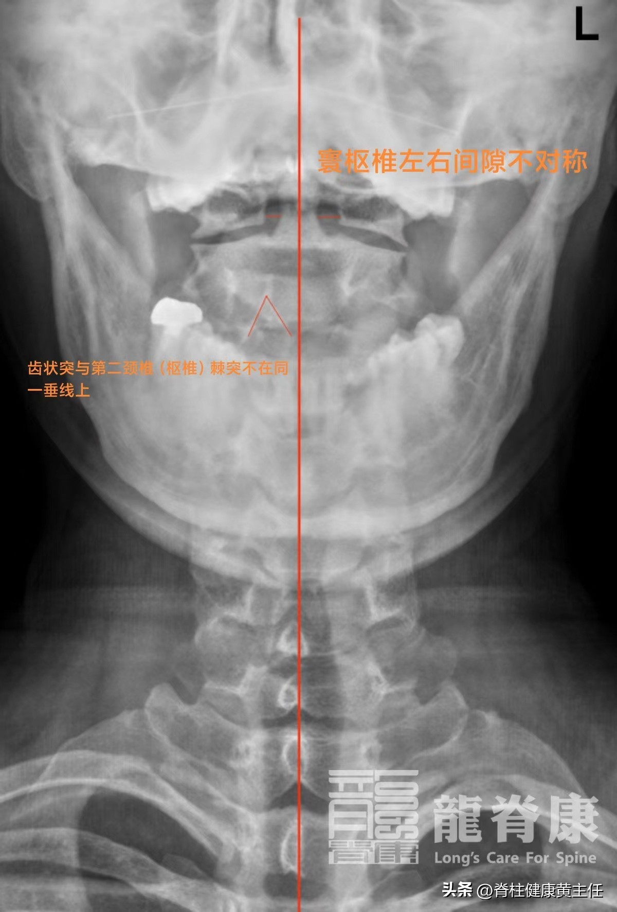 头晕恶心想吐全身没力犯困出冷汗,坐车头晕恶心想吐出冷汗怎么回事