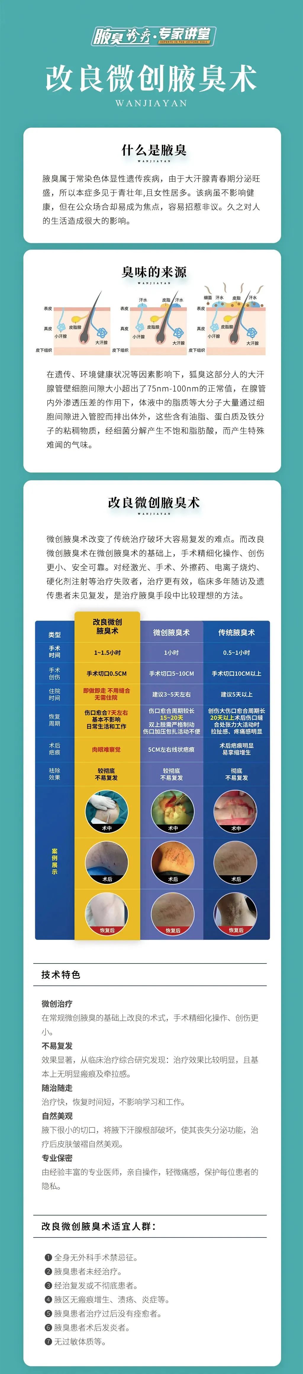 胸部大的女生有狐臭怎么办,狐臭严重的女孩怎么办