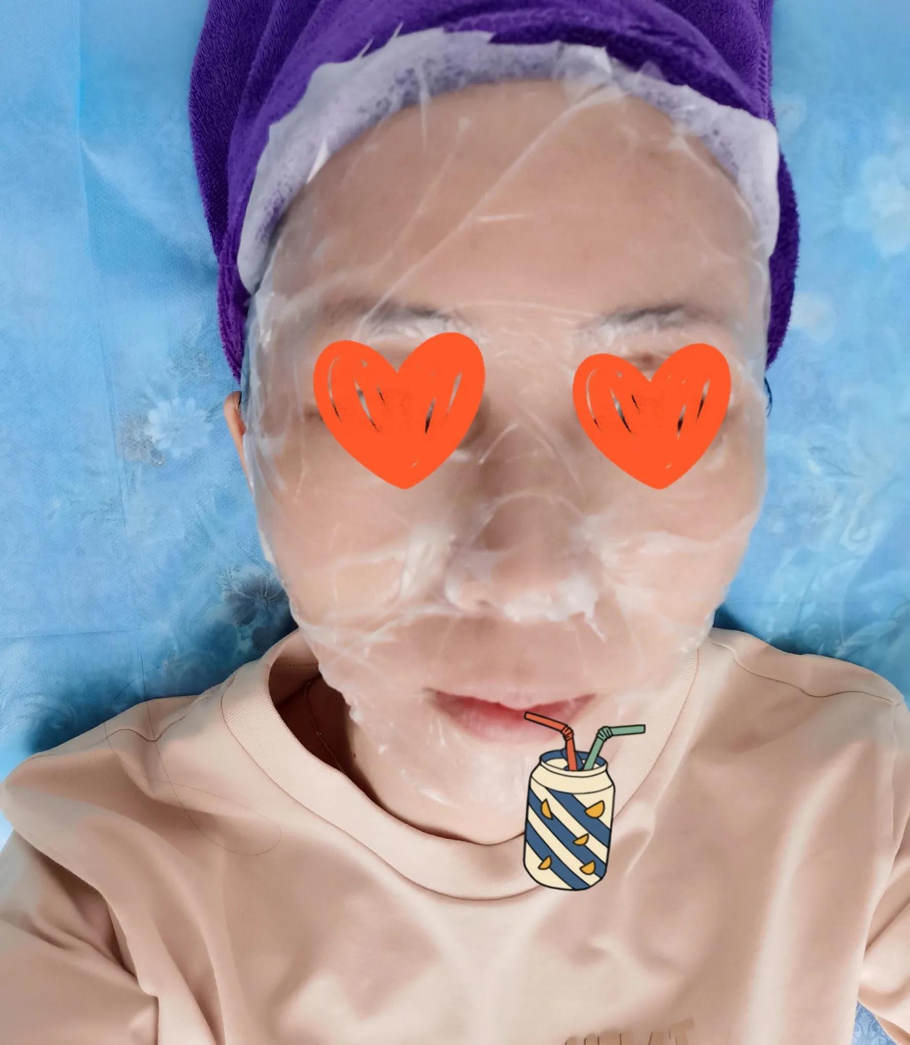 光子嫩肤+水光针体验报告～没有想象中的疼