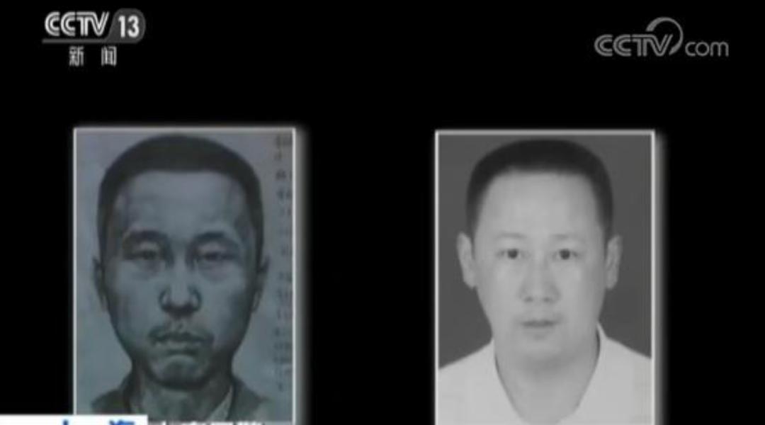 20岁女人整容失败案例,女人整容失败电视剧