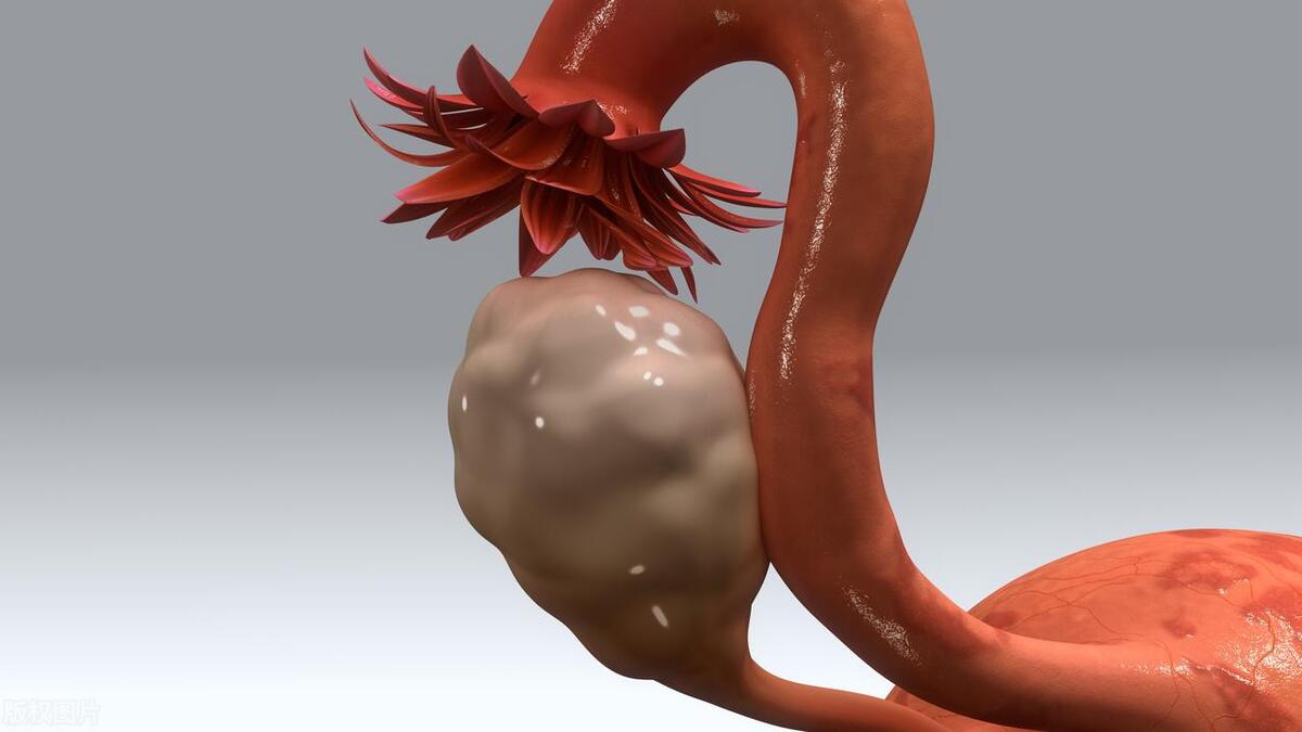 宫颈口松弛对女性有什么影响,宫颈口松弛是什么原因引起的