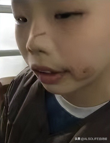 大龄自闭症托养机构大约要多少钱,大龄自闭症托养康复就业