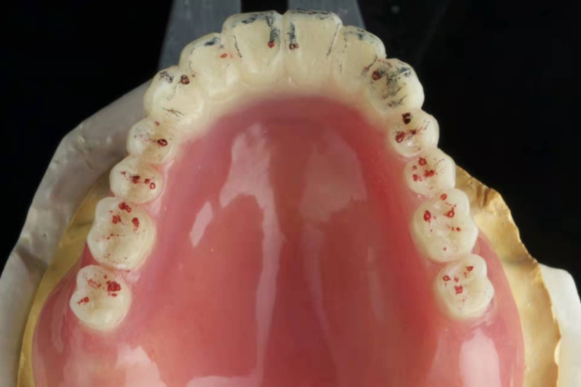 在北京房山种植牙怎么选,房山口腔牙科种植牙价格表