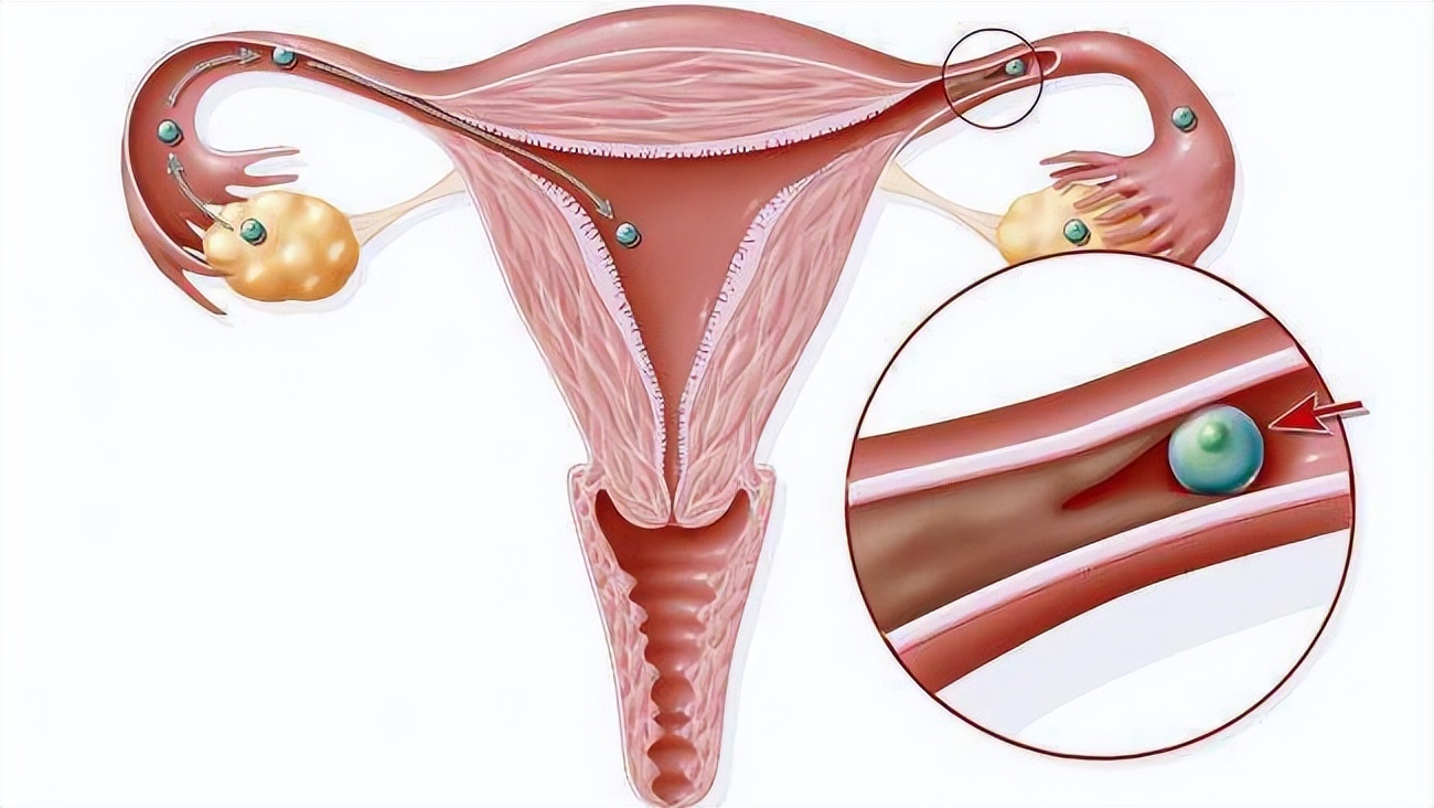 女人打过胎再怀孕容易吗,打过胎的女人要多注意什么