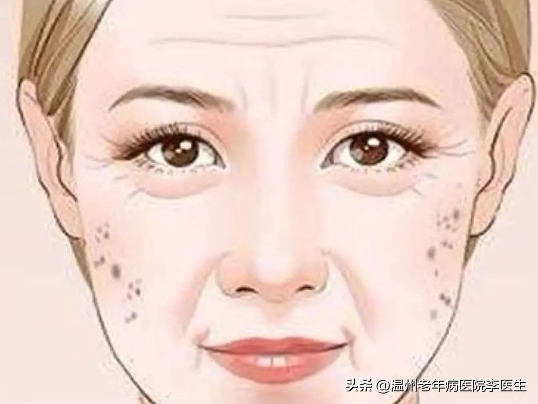 淡斑超光子,美白嫩肤光子