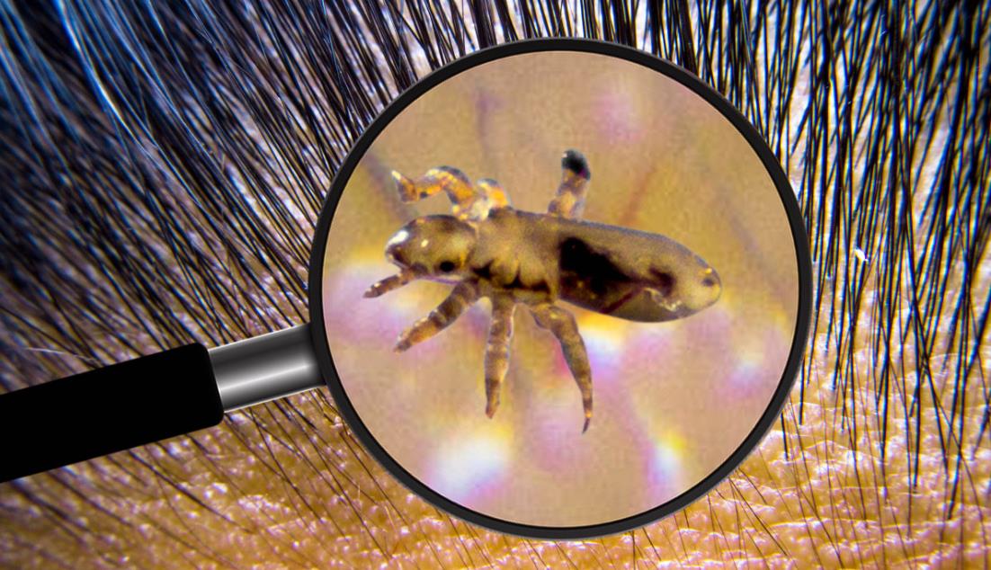 阴虱病怕什么,阴虱可怕吗怎样才能处理干净