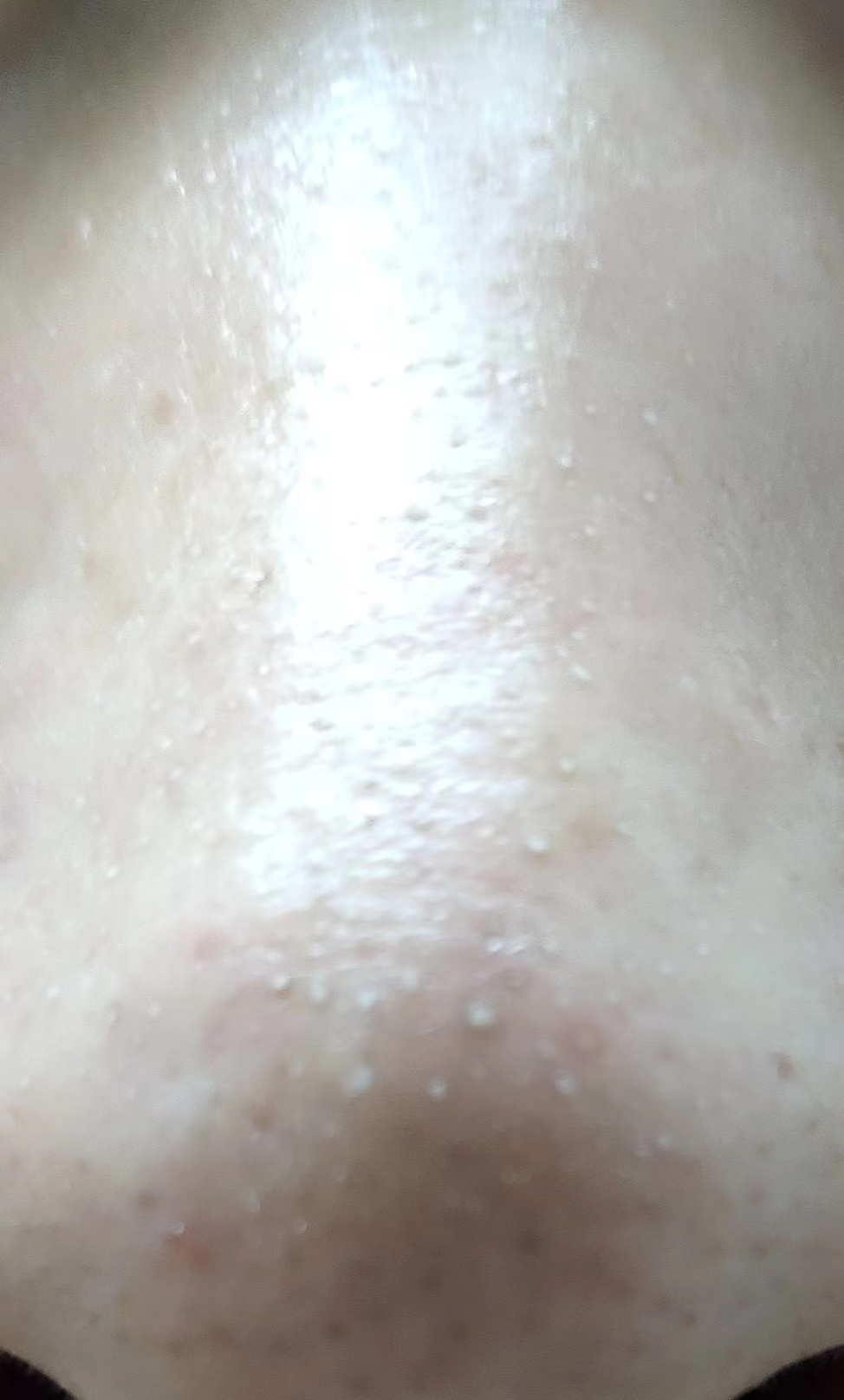 上完粉底液鼻子上有白点,涂粉底液后毛孔有白点点