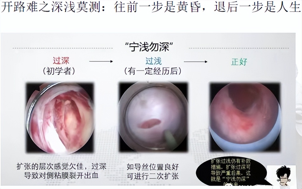 明知山有虎,偏向虎山行——肾斗士VS肾结石