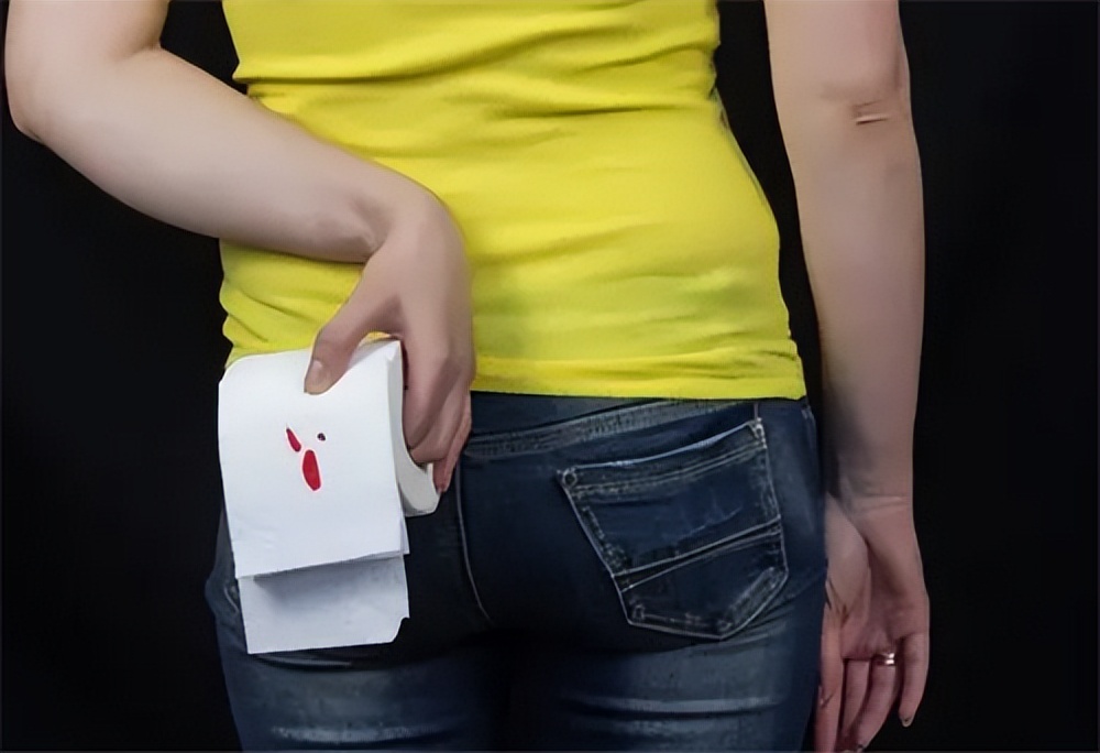 22岁女子肛瘘,高位复杂肛瘘患者自述