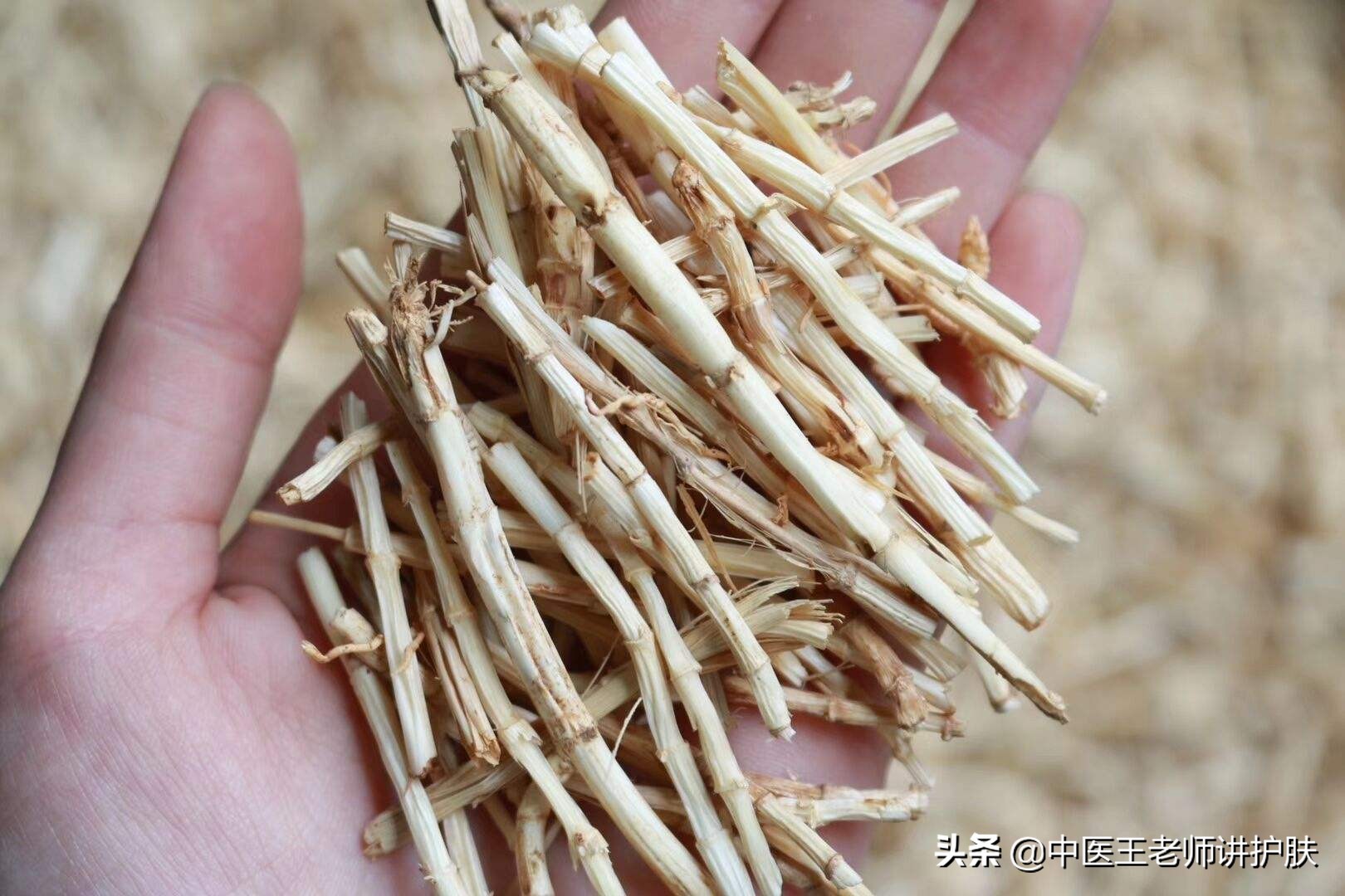 女性脂溢性脱发补肝肾气血有用吗,脂溢性脱发为什么祛风活络