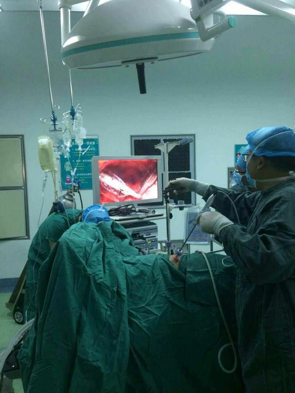 腹腔镜肾切除示意图,腹腔镜肾脏部分切除术