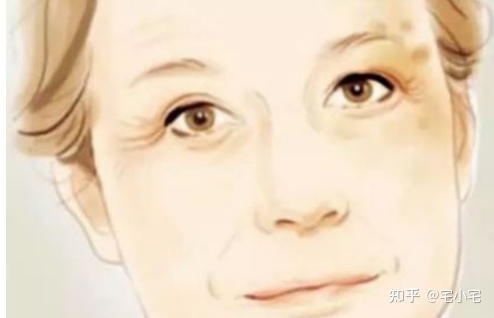 美白淡斑和美白祛斑有什么区别吗,美白和祛斑的区别