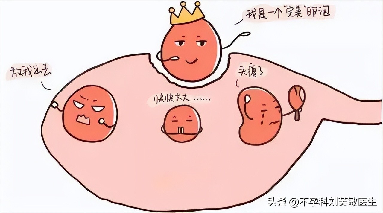 多囊促进卵泡发育的方法,多囊卵巢吃啥药能让卵泡快速生长