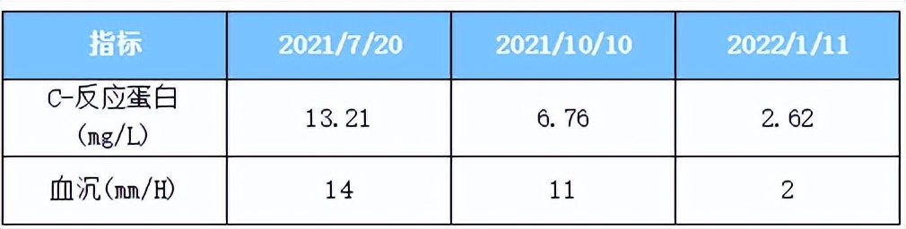 强直打司库奇尤单抗腿还是有点疼,司库奇尤单抗对强直的治疗