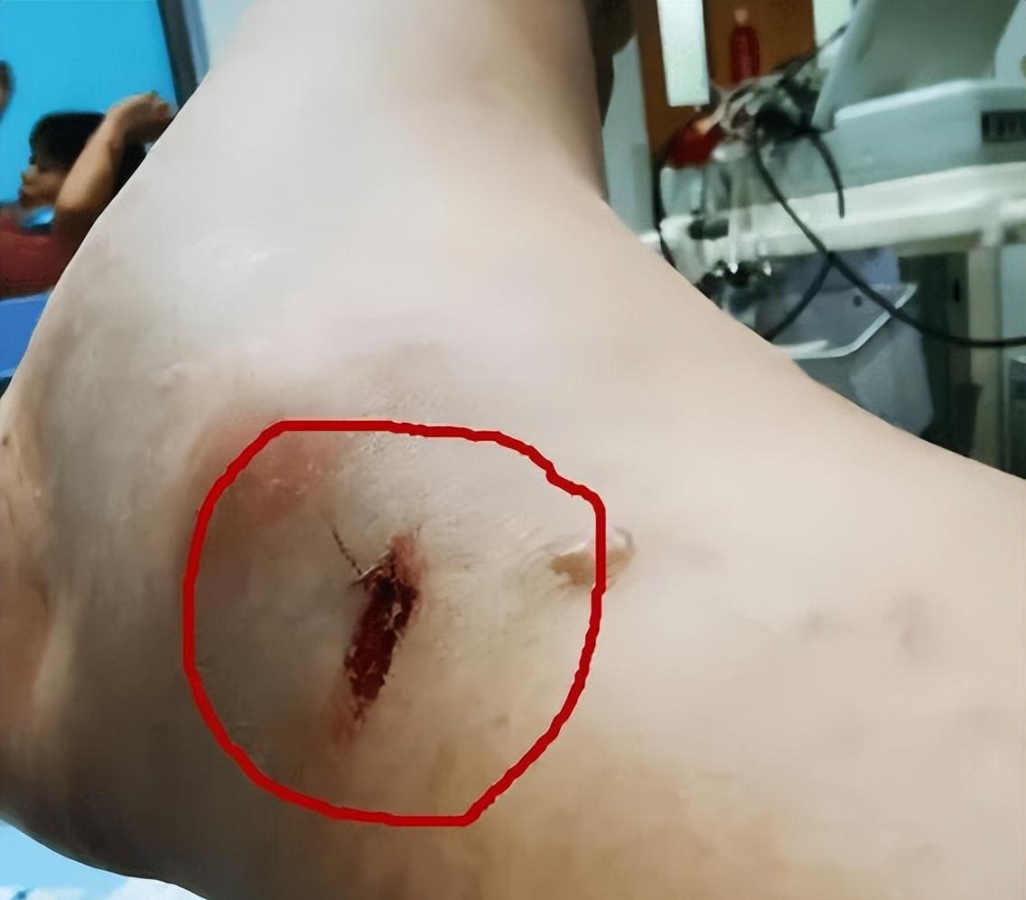 重庆某小区频繁出现剧毒蛇,重庆的剧毒蛇