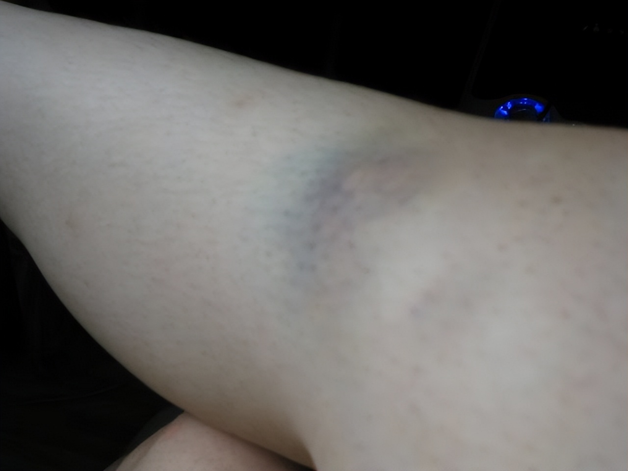 手脚麻脸有时麻是什么病,手脚麻是神经还是血管问题