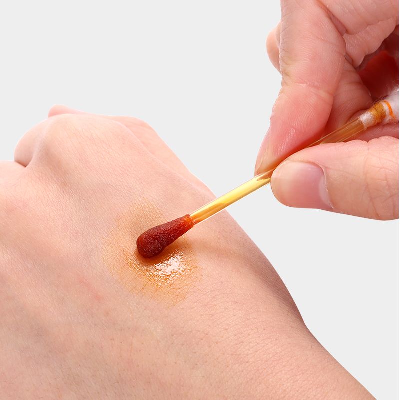 湿疹跟精神因素有关吗,湿疹总在快要好的时候复发