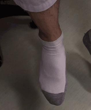 足内翻脚后跟不落地矫正的方法,怎样锻炼足踝矫正足内翻