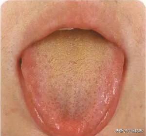 治脾不治肝,养肝疏肝调理脾胃的中成药