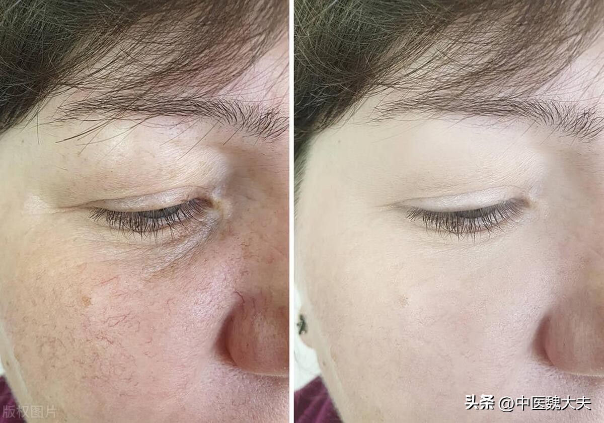 习惯在睡前玩下手机，用不了多久，就会摊上这4个“毛病”