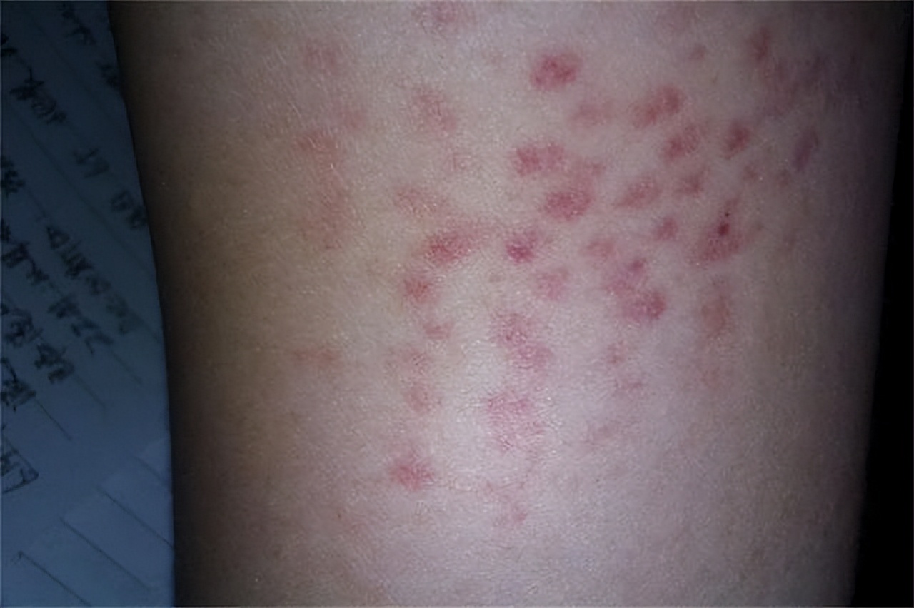 05年四川8岁白血病女孩不愿拖累养父，悄悄写下：自愿放弃治疗