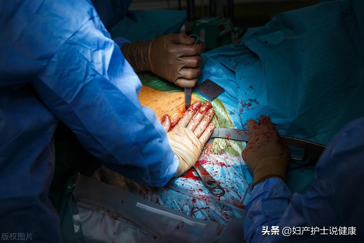 75岁老人腹胀肚子疼,82岁老太太肝硬化晚期突然肚子疼