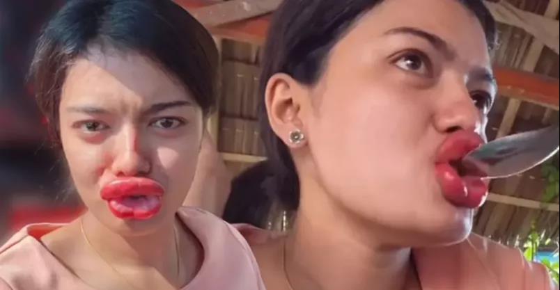 笑不活了女教师纹唇导致嘴唇过度“丰满”