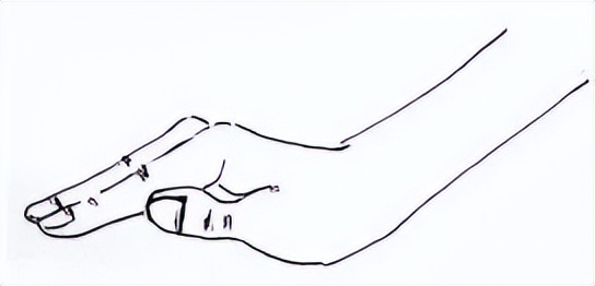 转阴一直咳嗽会引发肺炎吗,肺炎治愈后一直咳嗽什么原因